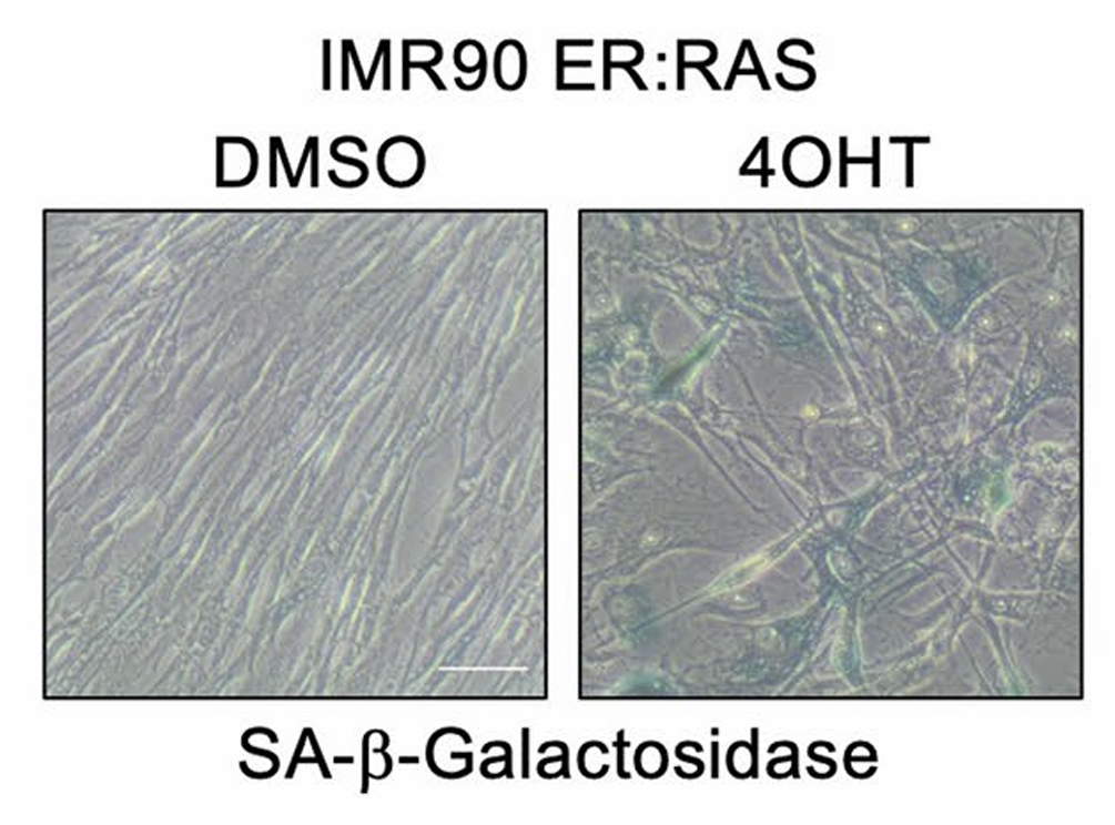 Left: control IMR90 cells. Right: IMR90 cells displaying oncogene induced senescence. From McHugh et al., 2023.